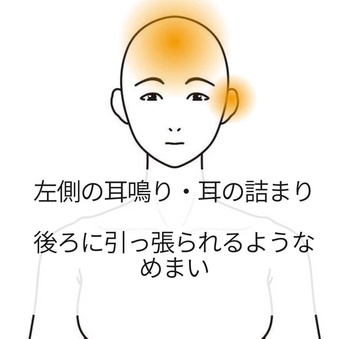 耳鳴り・めまいの症例（院長施術）