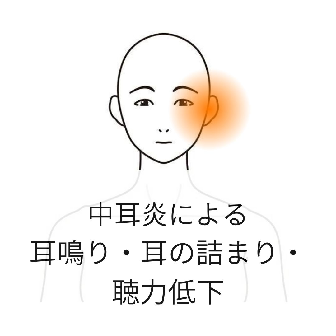 中耳炎の症例（院長施術）