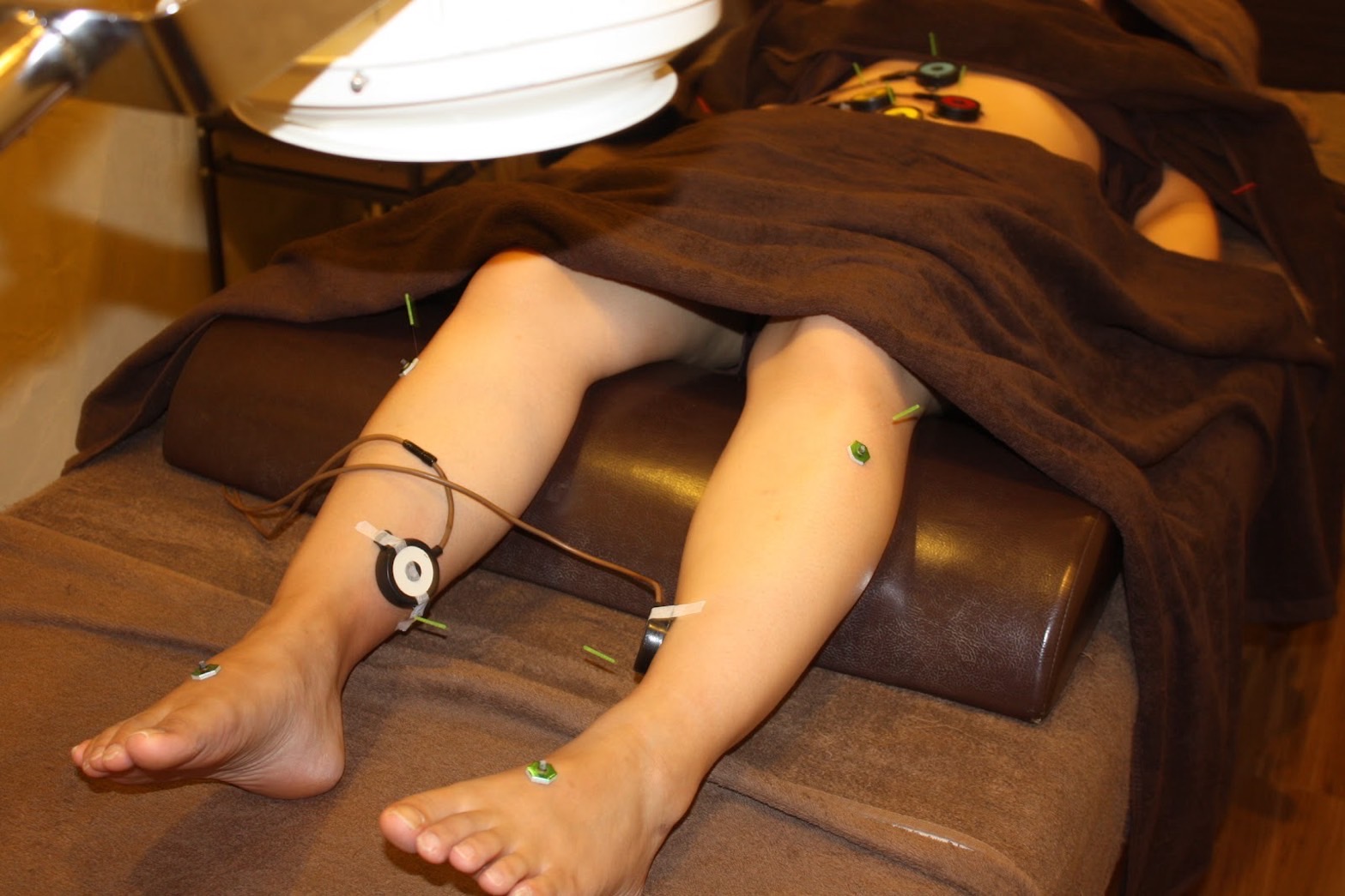 逆子（骨盤位）を鍼灸で整える：東洋医学と西洋医学の両面からアプローチ