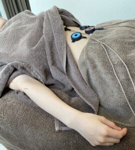 自律神経を整えるお腹への鍼灸施術