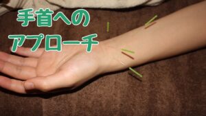 鍼灸によるTFCC損傷施術