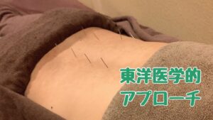 PMSの鍼灸施術